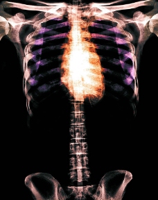骨骼 透视 X光 科技  身躯 胸图片